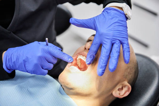 Best Emergency Dentist for Knocked-Out Tooth in Indiana, PA