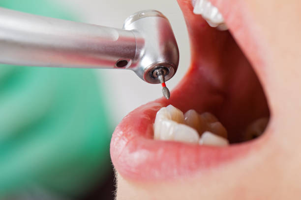 Best Emergency Dentist for Knocked-Out Tooth in Indiana, PA
